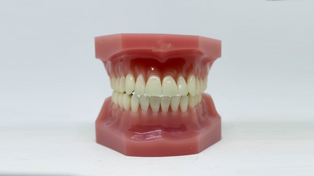 A Dental Model on a White Surface
